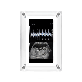 Cozie Frame™ Digital Frame